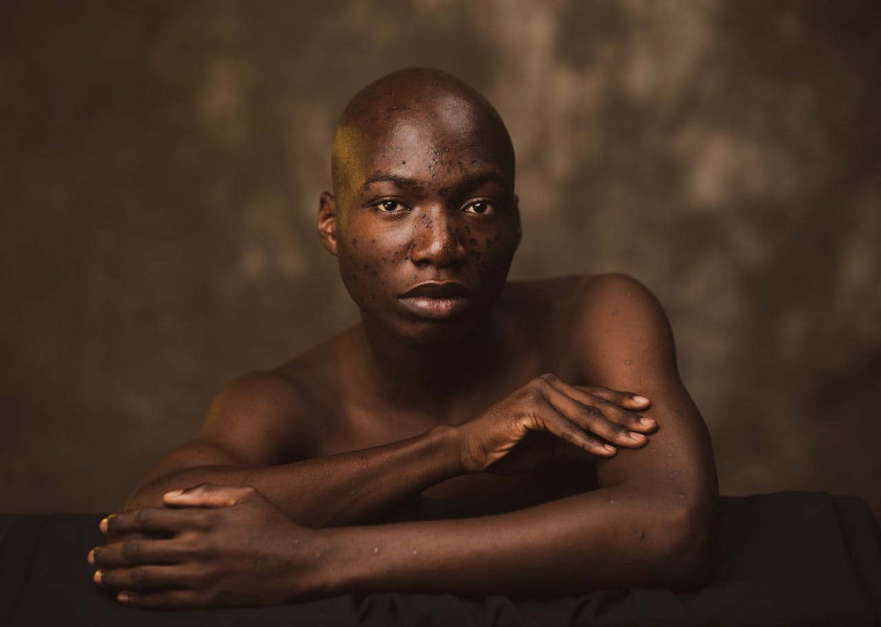 Portrait of a Shirtless Man with Freckles 